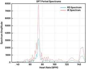 動態(tài)離散周期變換技術(shù)突破：無ECG參考的生理信號精準(zhǔn)解析